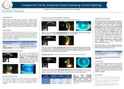Unexpected Clarity: Improved Vision Following Corneal Hydrops