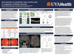 Emily Benson, OD,MS Early detection of retrobulbar optic neuritis leads to a diagnosis of multiple sclerosis