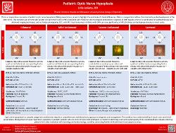 Pediatric Optic Nerve Hypoplasia
