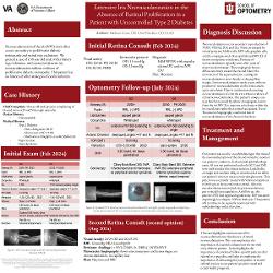 Madison Gross, OD Extensive Iris Neovascularization in the absence of Retinal Proliferation in a patient with uncontrolled Type 2 Diabetes