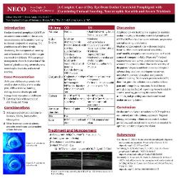 A Complex Case of Dry Eye from Ocular Cicatricial Pemphigoid with Correlating Corneal Scarring, Neurotrophic Keratitis, and Severe Trichiasis