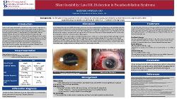 Silent Instability: Late IOL Dislocation in Pseudoexfoliation Syndrome