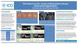 The Pressure Is On: A Case of Minocycline-Induced Intracranial Hypertension
