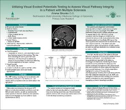 Application of Visual Evoked Potentials to Assess Visual Pathway Integrity in a Patient with Multiple Sclerosis