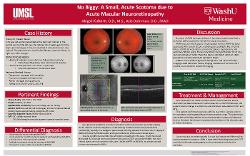 No Biggy: A Small Paracentral Scotoma due to Acute Macular Neuroretinopathy