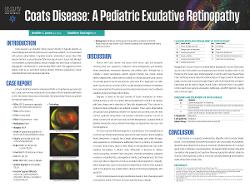 Coats Disease: A Pediatric Exudative Retinopathy