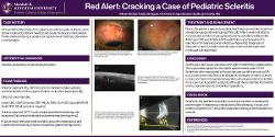 Red Alert: Cracking a Case of Pediatric Scleritis