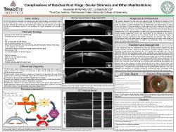 Complications of residual rust rings: siderosis and other related manifestations