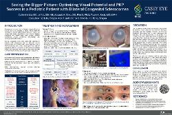 Seeing the bigger picture: optimizing visual potential and PKP success in a pediatric patient with bilateral congenital sclerocornea