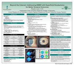 Beyond the Cataract: Addressing EBMD With Superficial Keratectomy for Better Surgical Precision