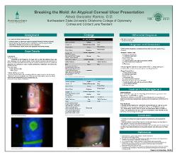 Breaking the Mold: An Atypical Corneal Ulcer Presentation