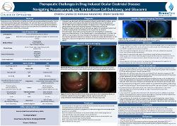 Therapeutic Challenges in Drug-Induced Ocular Cicatricial Disease: Navigating Pseudopemphigoid, Limbal Stem Cell Deficiency, and Glaucoma