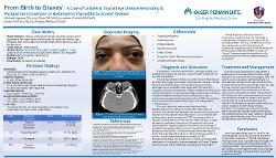 From Birth to Graves’: A case of unilateral Thyroid Eye Disease secondary to postpartum conversion of Hashimoto’s Thyroiditis to Graves’ Disease