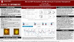 Diurnal IOP Fluctuation and Monitoring in Glaucoma Management