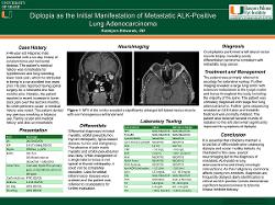 Diplopia as the Initial Manifestation of Metastatic ALK-Positive Lung Adenocarcinoma
