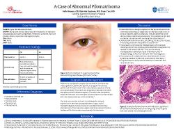 A Case of Abnormal Pilomatrixoma