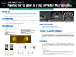 More Than Meets the Eye: Pediatric Blurred Vision as a Clue to Pituitary Macroadenoma
