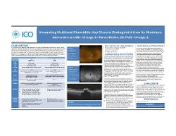 Unmasking Multifocal Choroiditis: Key Clues to Distinguish it from Its Mimickers