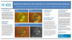 Nettleship Collateral: A Rare Indication of a Central Retinal Artery Occlusion