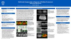 Multimodal Imaging Aids in Diagnosis of Multiple Evanescent White Dot Syndrome