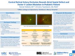 Central Retinal Artery Occlusion Reveals Atrial Septal Defect and Factor V Leiden Mutation in Pediatric Patient