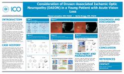 Consideration of Drusen-Associated Ischemic Optic Neuropathy (DAION) in a Young Patient with Acute Vision Loss