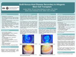 Graft-Versus-Host Disease Secondary to Allogenic Stem Cell Transplant