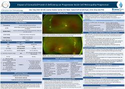 Impact of comorbid protein S deficiency on progressive sickle cell retinopathy progression