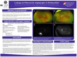 Leakage on Fluoresceine Angiography in Retinoschisis
