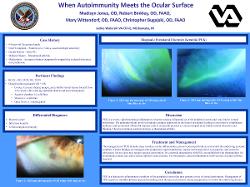 When Autoimmunity Meets the Ocular Surface